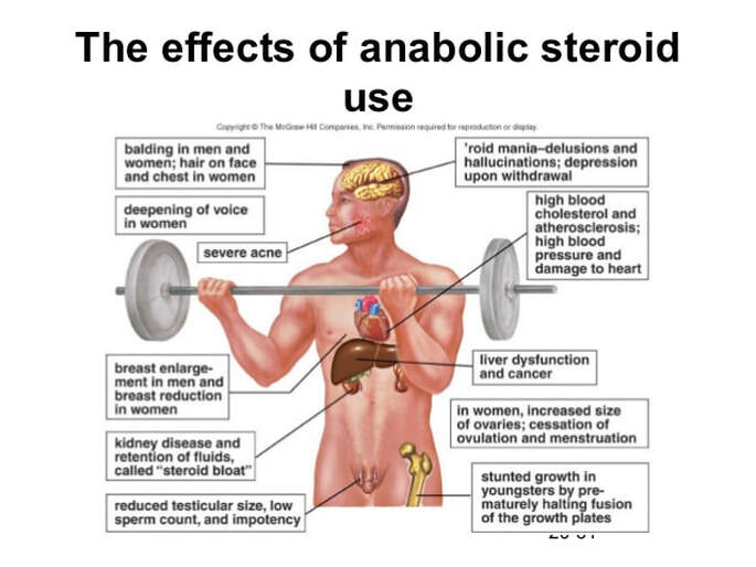 The Use (and Risks) of Anabolic Steroids in Sports
