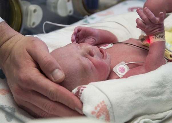 Woman with Transplanted Uterus Gives Birth