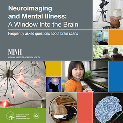 Advancements in Neuroimaging Technology