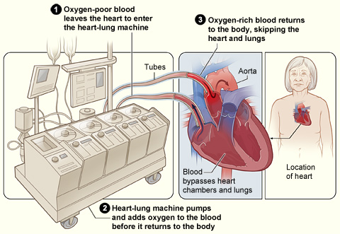 Advancements in Heart and Lung Surgery