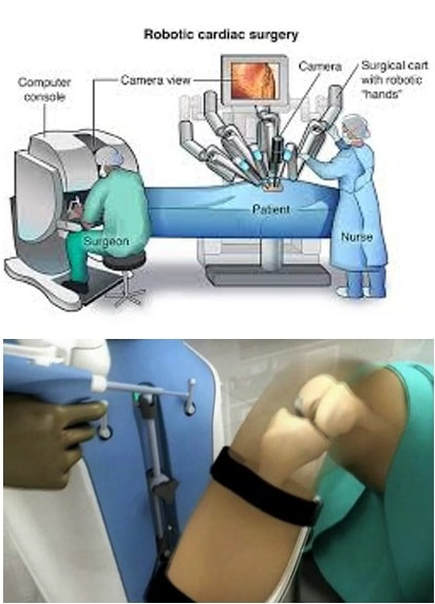 Robotic-assisted Surgery